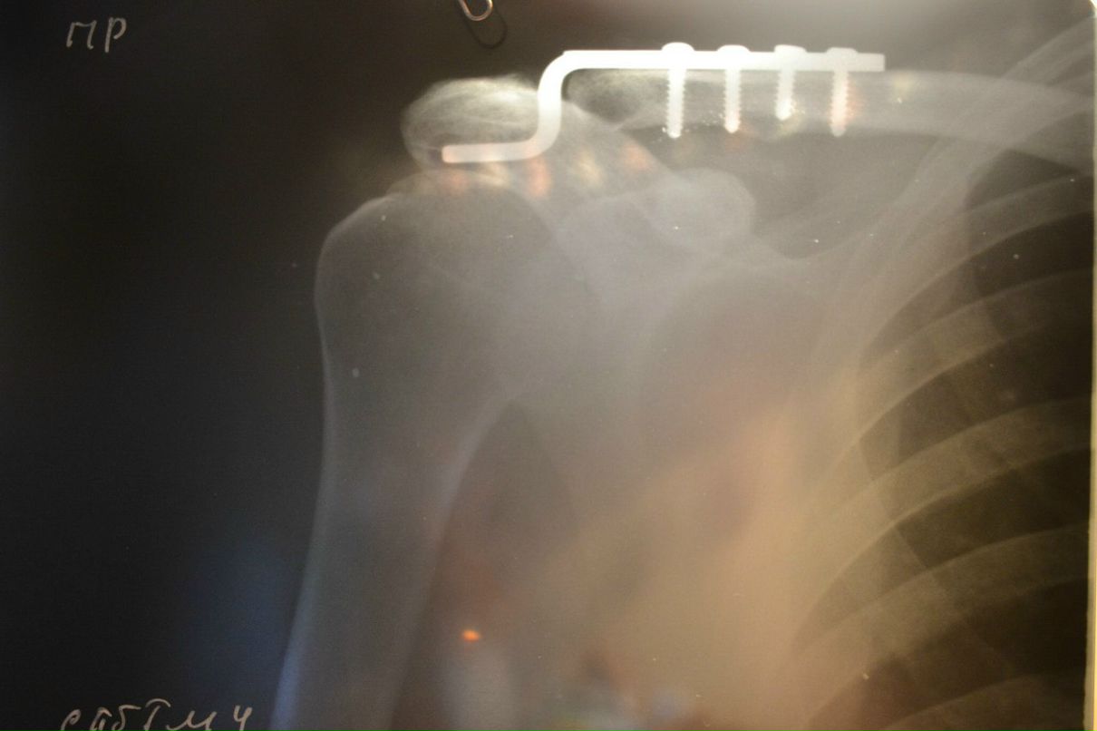 Евген Лопатi фотография #6